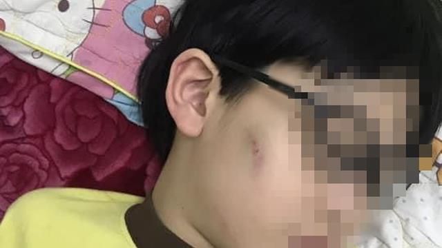 Làm rõ thông tin bé trai 8 tuổi bị mẹ đánh vì chưa làm bài tập