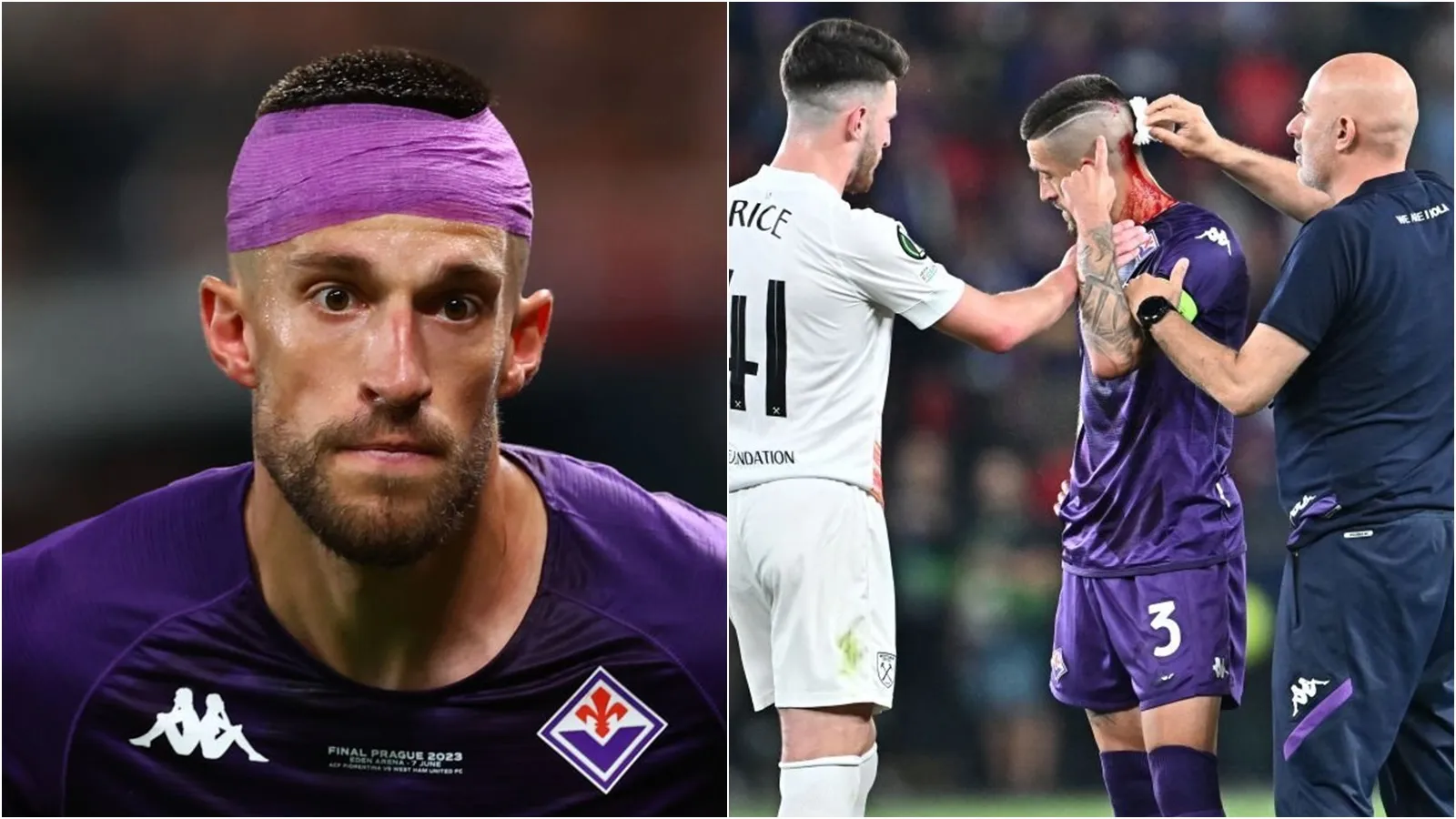 Bị CĐV West Ham làm chảy máu đầu, đội trưởng Fiorentina đáp trả đẳng cấp