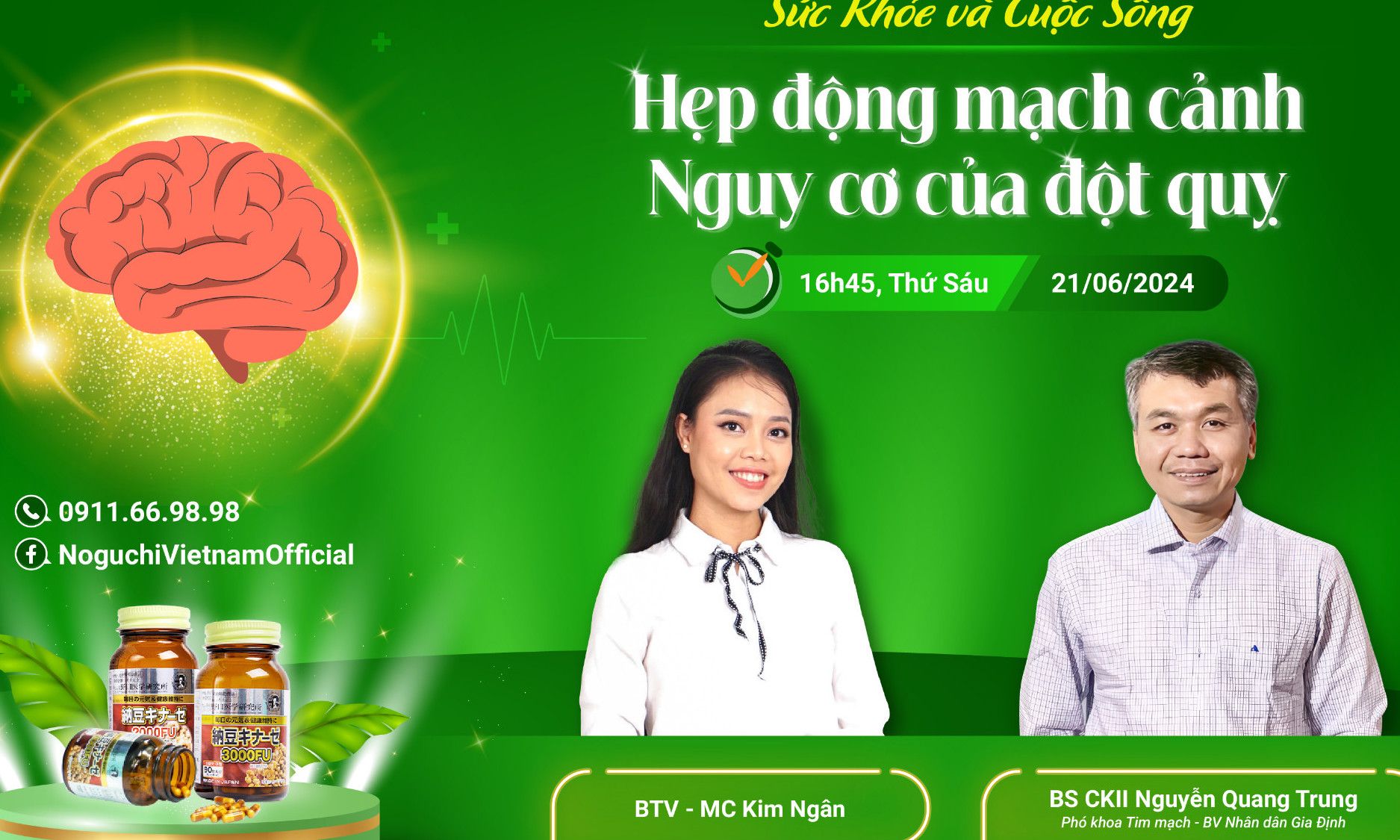 Hẹp động mạch cảnh- nguy cơ của đột quỵ