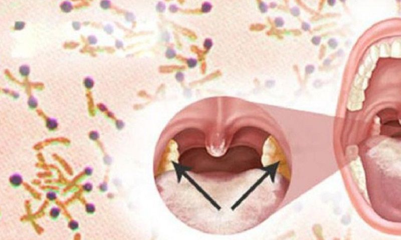 Cách phòng tránh lây nhiễm bệnh bạch hầu