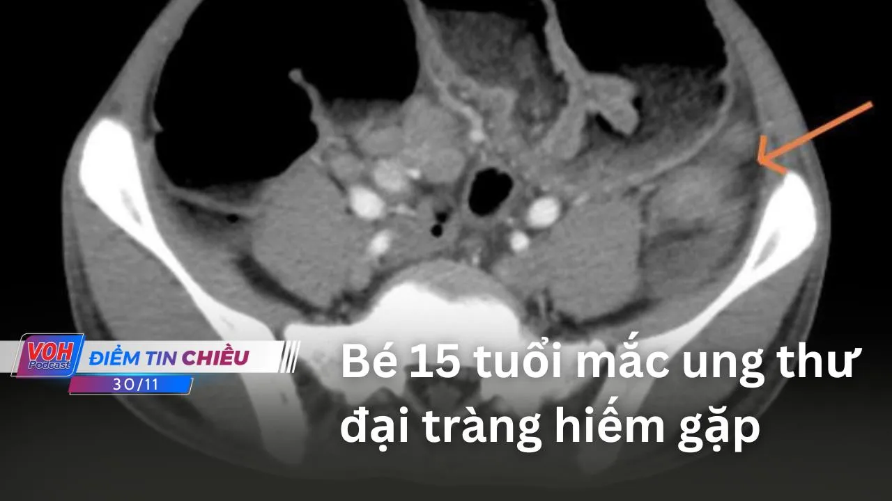 Điểm tin chiều 30/11: Xuất khẩu nông sản vượt kỷ lục; Sẽ xử phạt quán cà phê đường tàu