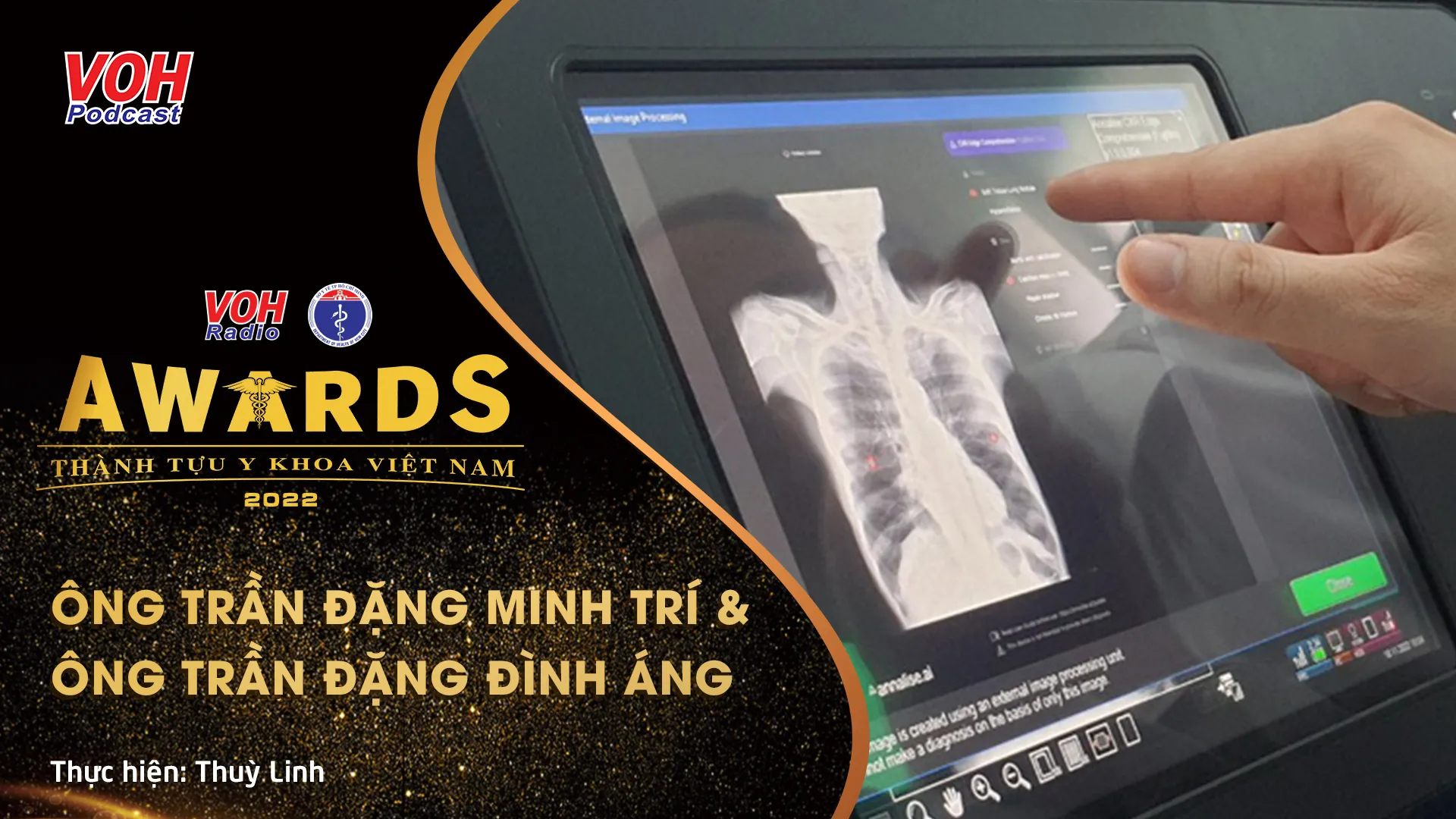 Đề cử 08: Đưa AI chẩn đoán X-quang phổi về phục vụ công tác tại xã đảo Thạnh An