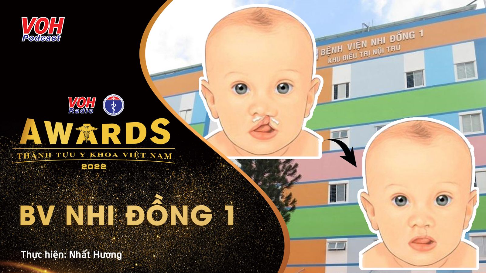 Đề cử 10: Trả lại giọng nói và nụ cười cho 10.000 trẻ bị sứt môi chẻ vòm