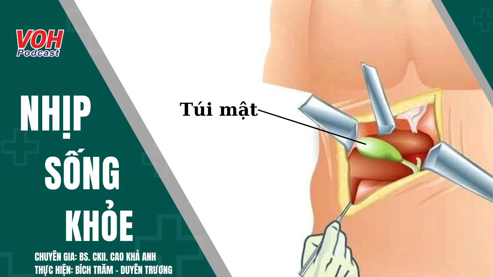 Cắt bỏ túi mật – ảnh hưởng chất lượng cuộc sống ra sao?